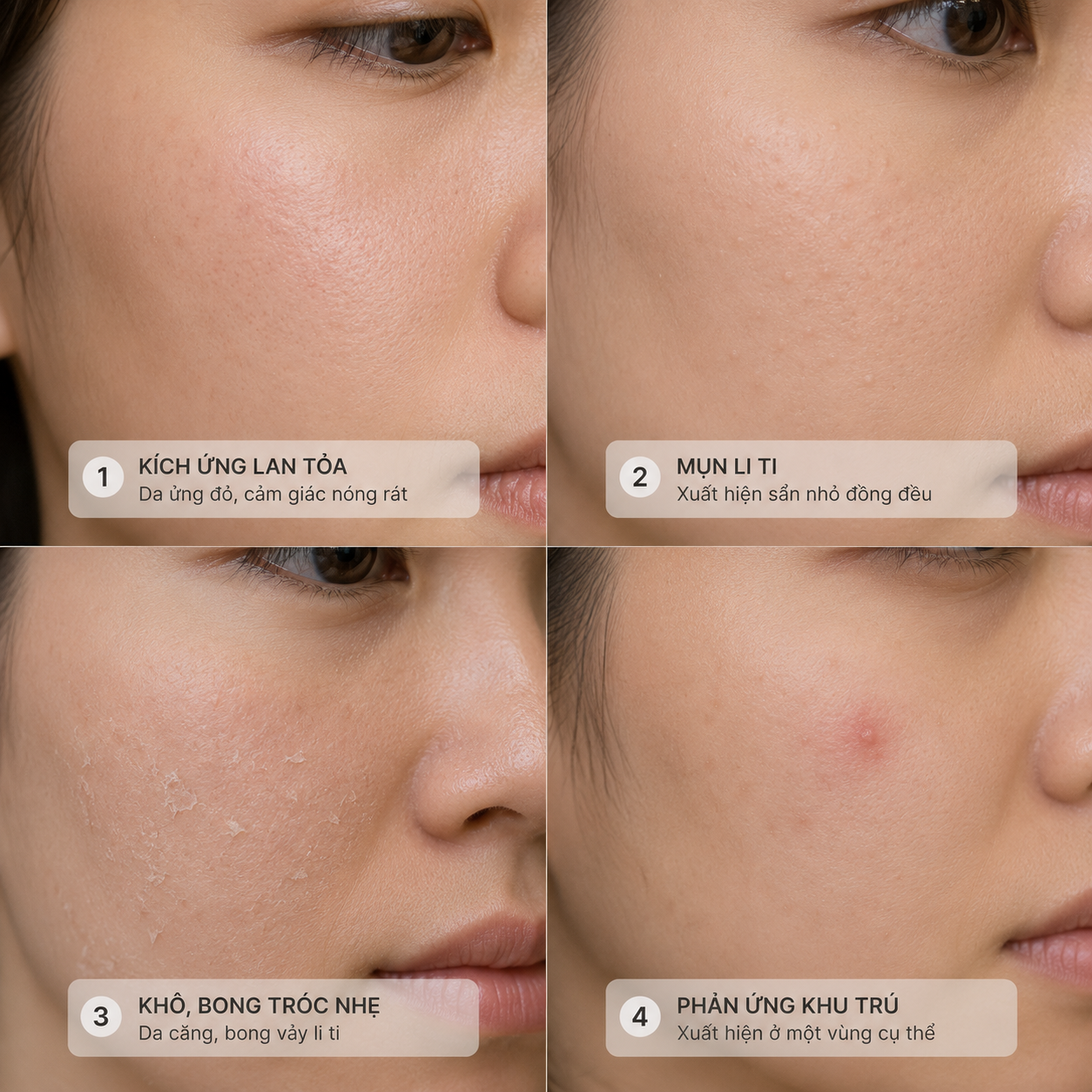 4 loại phản ứng bất lợi sau điều trị