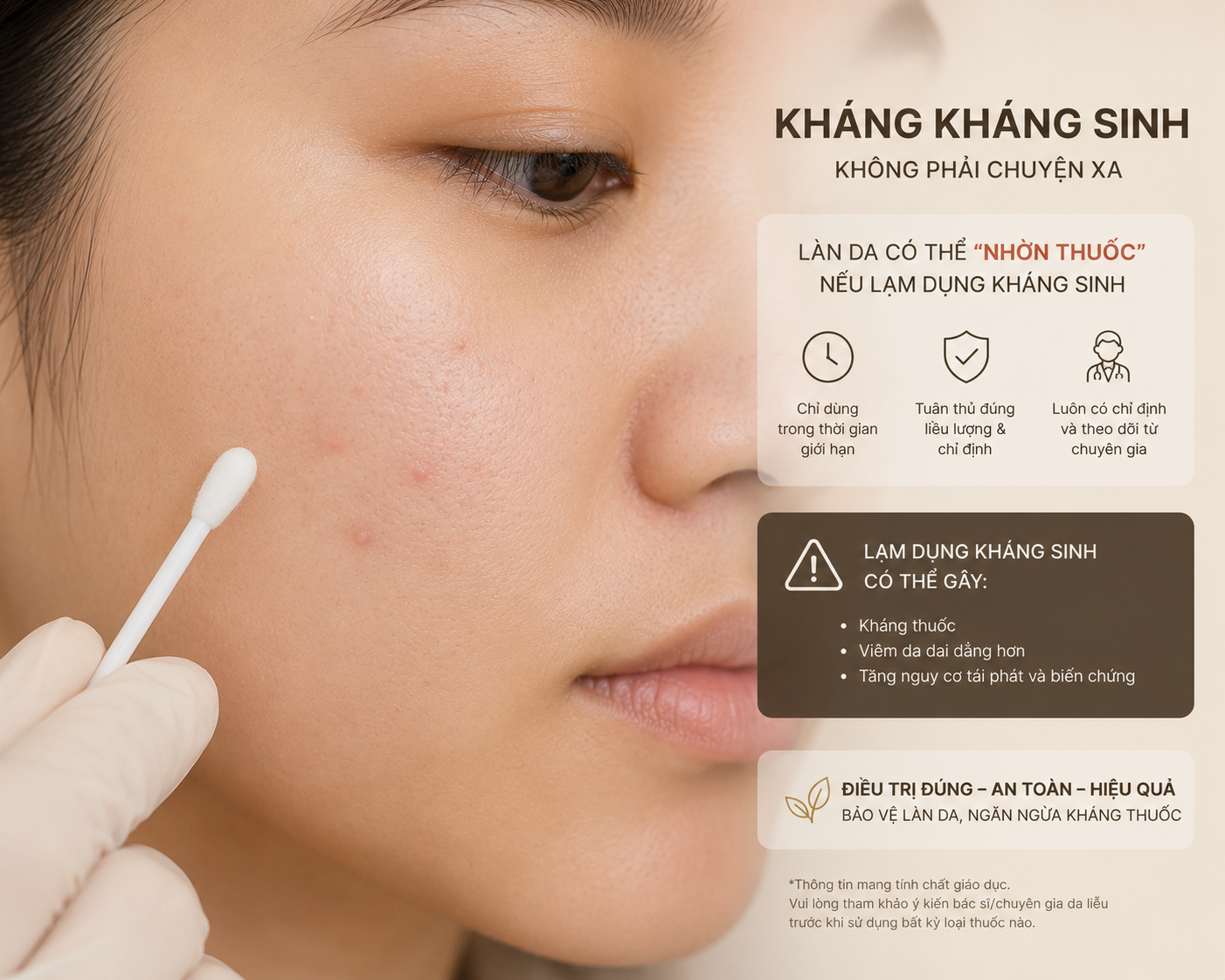 Kháng sinh bôi ngoài da trong điều trị mụn